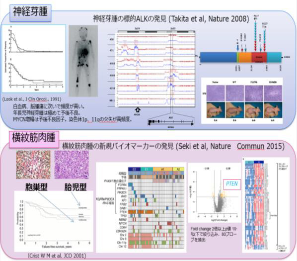 神経芽腫と横紋筋肉腫における先行研究
