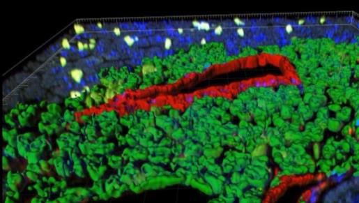 ヒト白血病化NOG マウスの肝臓内イメージ  胆管上皮細胞（赤）周囲に白血病細胞（緑）が集蔟
