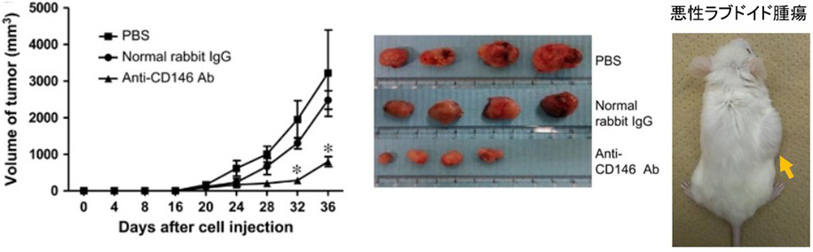 小児固形がんのPDXモデルを用いた分子標的治療や免疫治療の開発