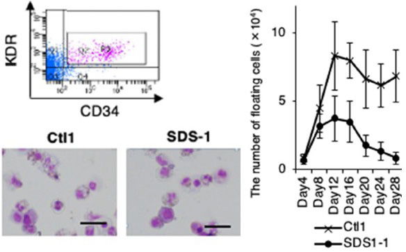 SDS患者のiPS細胞からの血球分化による病態再現